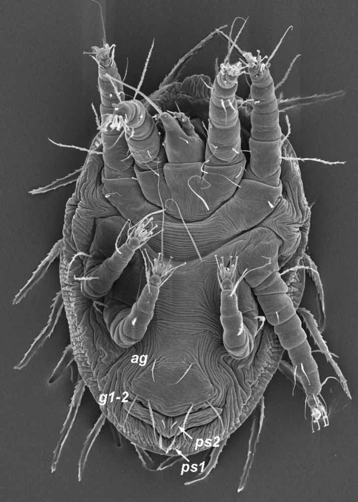            Fig. 3.   Australopalpus alphitoniae  female   venter (image: Gary Bauchan, USDA-ARS).   
