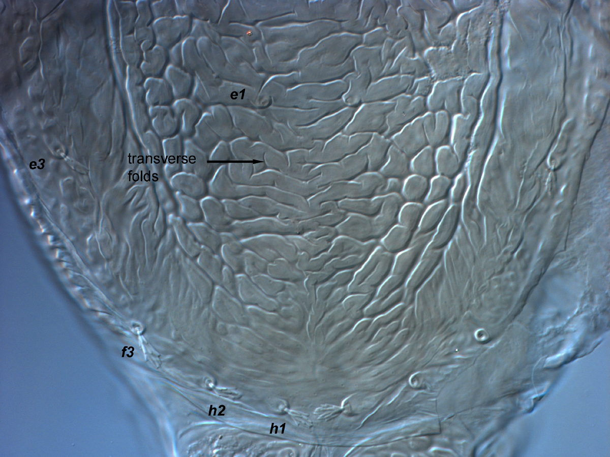  Fig. 9.  Brevipalpus tucuman , female posterior dorsum. 
