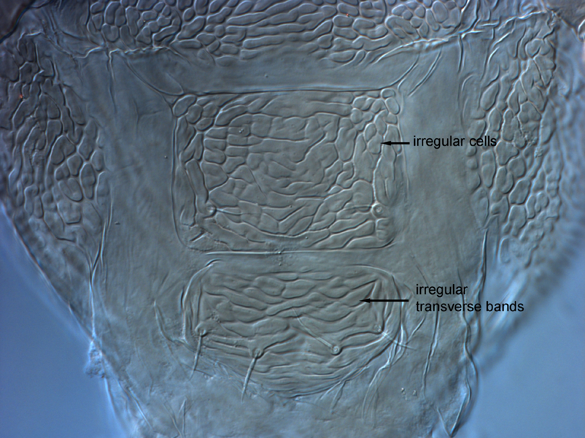  Fig. 14.  Brevipalpus tucuman , female posterior venter. 