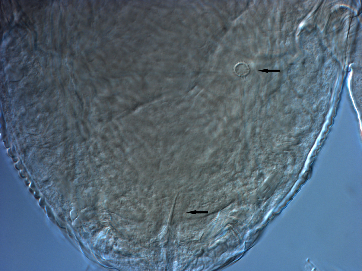  Fig. 16.  Brevipalpus tucuman , female spermatheca. 