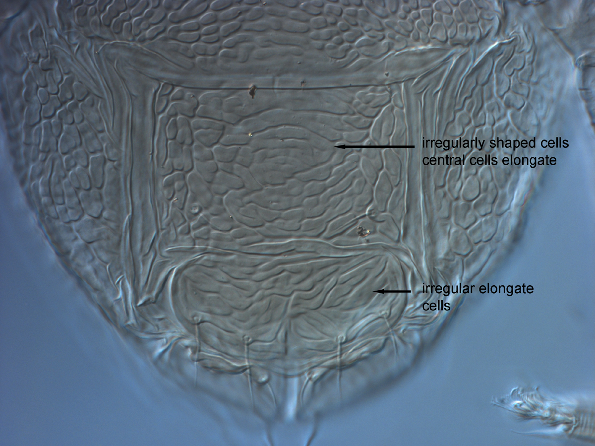  Fig. 15.  Brevipalpus tucuman , female posterior venter. 