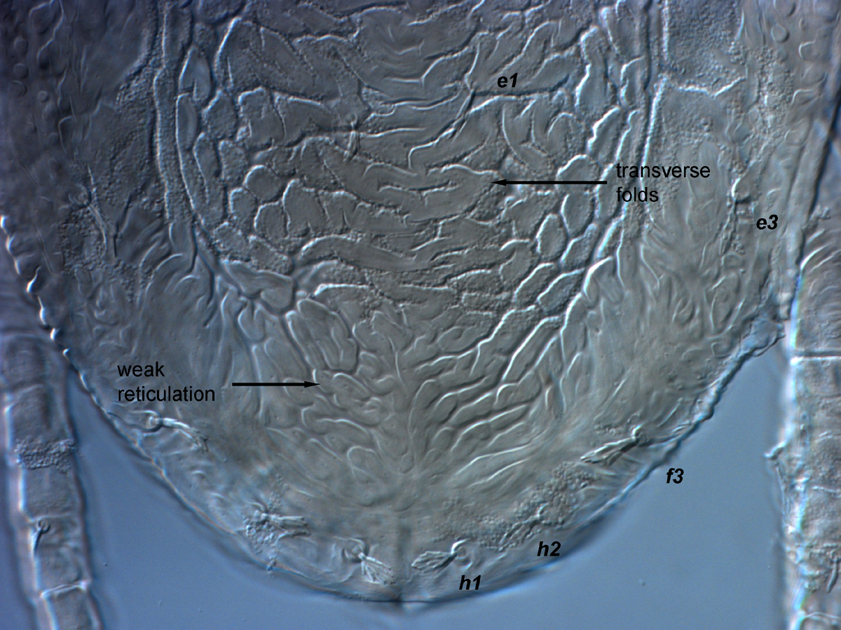  Fig. 10.  Brevipalpus tucuman , female posterior dorsum. 