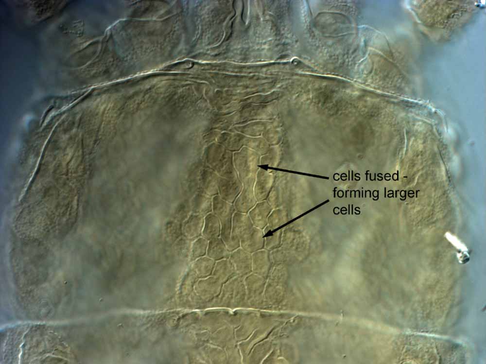            Fig. 5.   Brevipalpus californicus  group species   B, female prodorsum.   