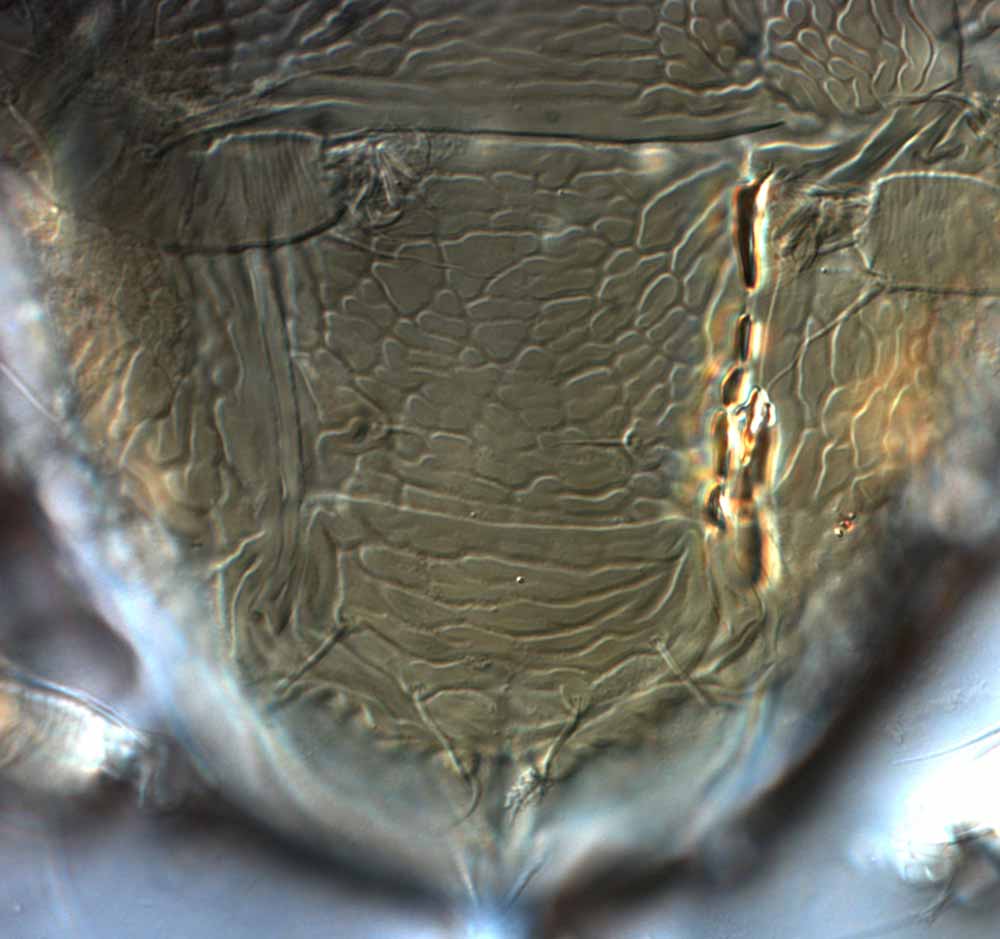            Fig. 13.   Brevipalpus californicus  group species B, female   posterior venter.   