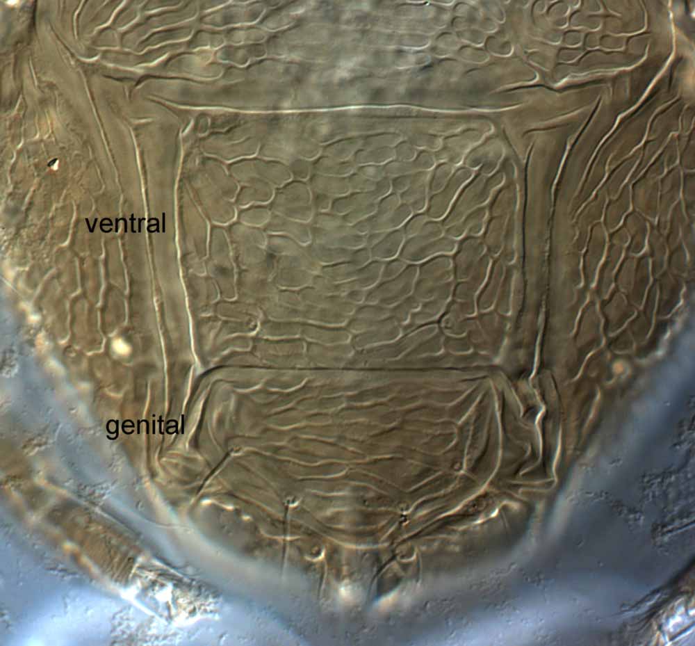            Fig. 12.   Brevipalpus californicus  group species   B, female posterior venter.   