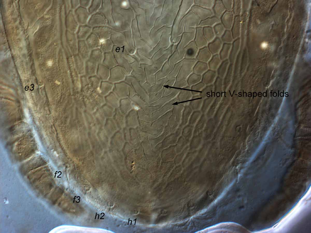            Fig. 11.   Brevipalpus californicus  group species B, female   posterior dorsal opisthosoma.   