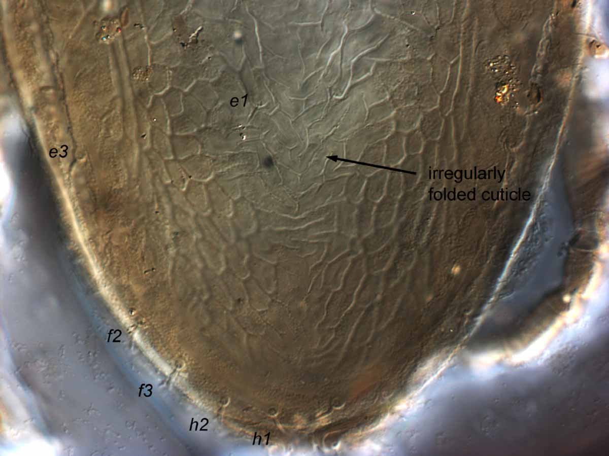            Fig. 10.   Brevipalpus californicus  group species B, female   posterior dorsal opisthosoma.   