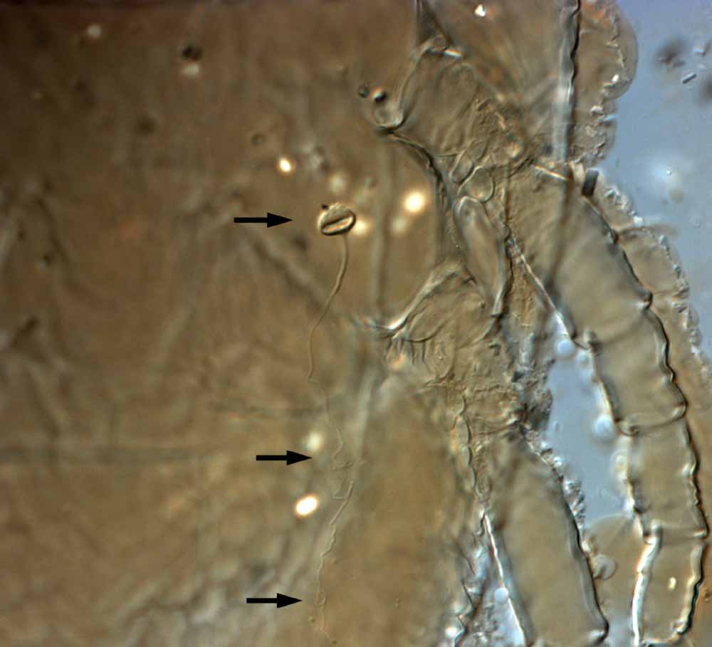            Fig. 15.   Brevipalpus californicus  group species   B, female spermatheca and duct (indicated by   arrows).   