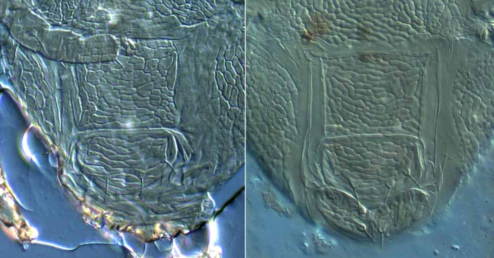            Fig. 14.   Brevipalpus californicus  group species B, female   posterior venter.   