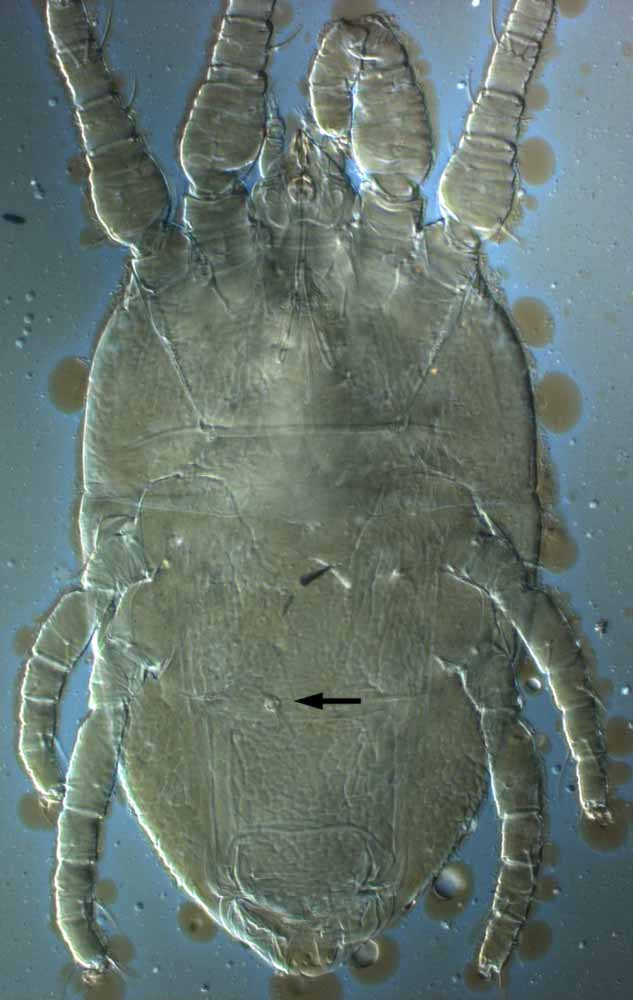            Fig. 16.   Brevipalpus californicus  group species   B, female spermatheca indicated by arrow.   
