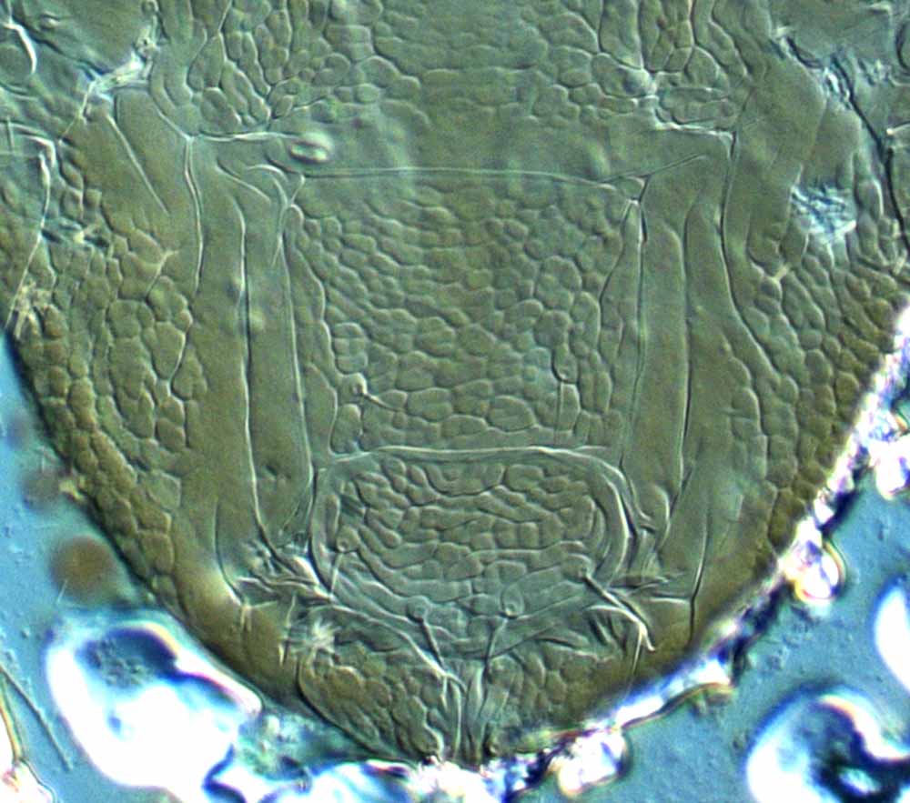            Fig. 2.   Brevipalpus californicus  group species C, female   posterior venter.   