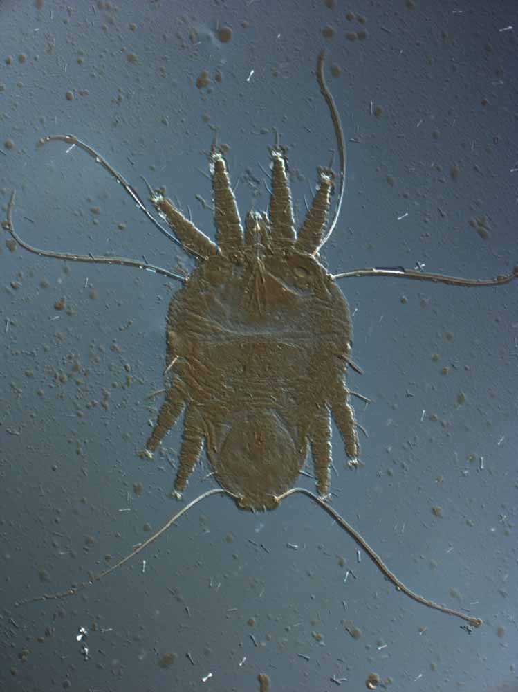            Fig. 9.   Brevipalpus chamaedoreae  deutonymph, indicating long    sc1 ,  sc2  setae on prodorsum.   