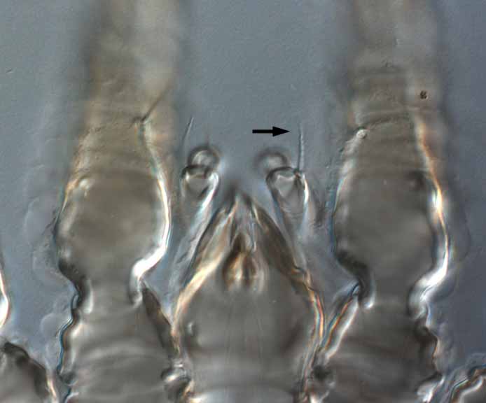            Fig. 8.   Brevipalpus chamaedoreae  female palp (arrow indicates   seta on palp femur).   
