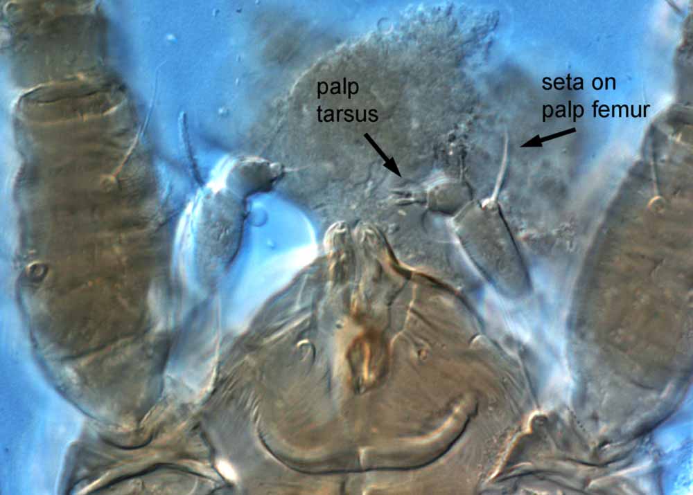            Fig. 10.   Brevipalpus cuneatus  female palp, indicating   small palp tarsus, and seta on palp femur.   