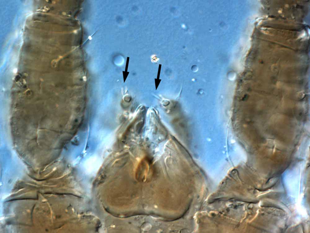            Fig. 11.   Brevipalpus cuneatus  female palp - arrow indicates 2   setae on palp tarsus.   