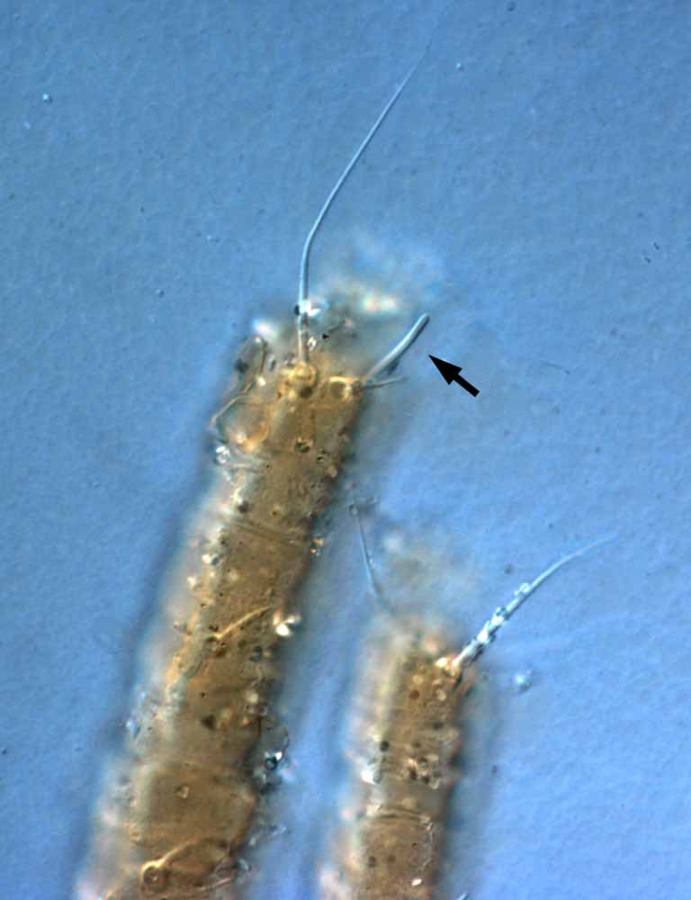            Fig. 2.   Brevipalpus cuneatus  female legs I-II - arrow   indicates long solenidion.   