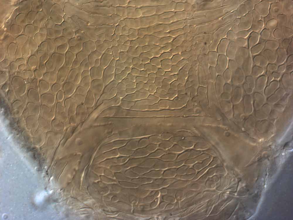            Fig. 8.   Brevipalpus cuneatus  female posterior venter - note   lack of well defined ventral plate.   