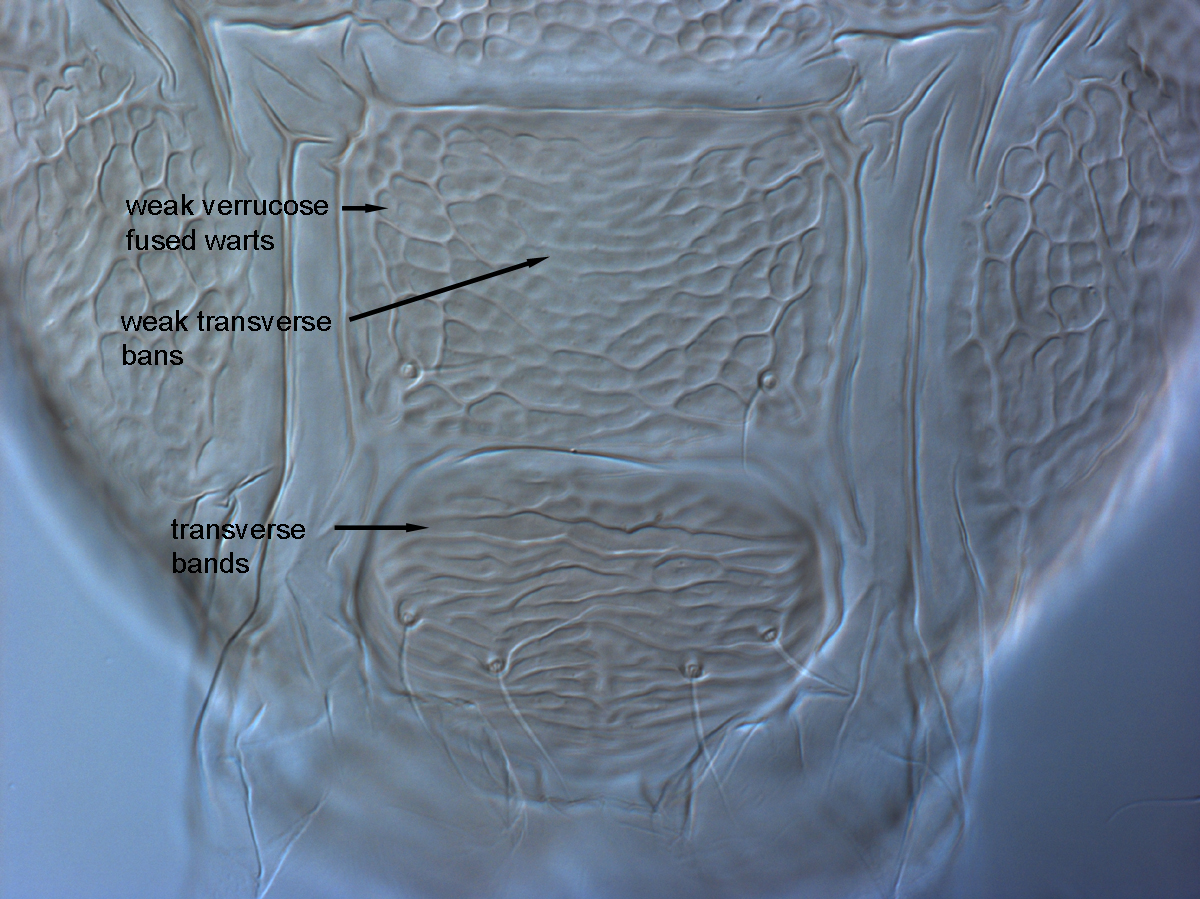 Fig. 10.  Brevipalpus ferraguti , female posterior venter. 