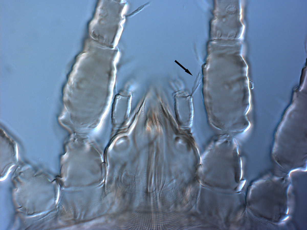  Fig. 8.  Brevipalpus ferraguti , dorsal seta on palp femurogenu (indicated by arrow). 