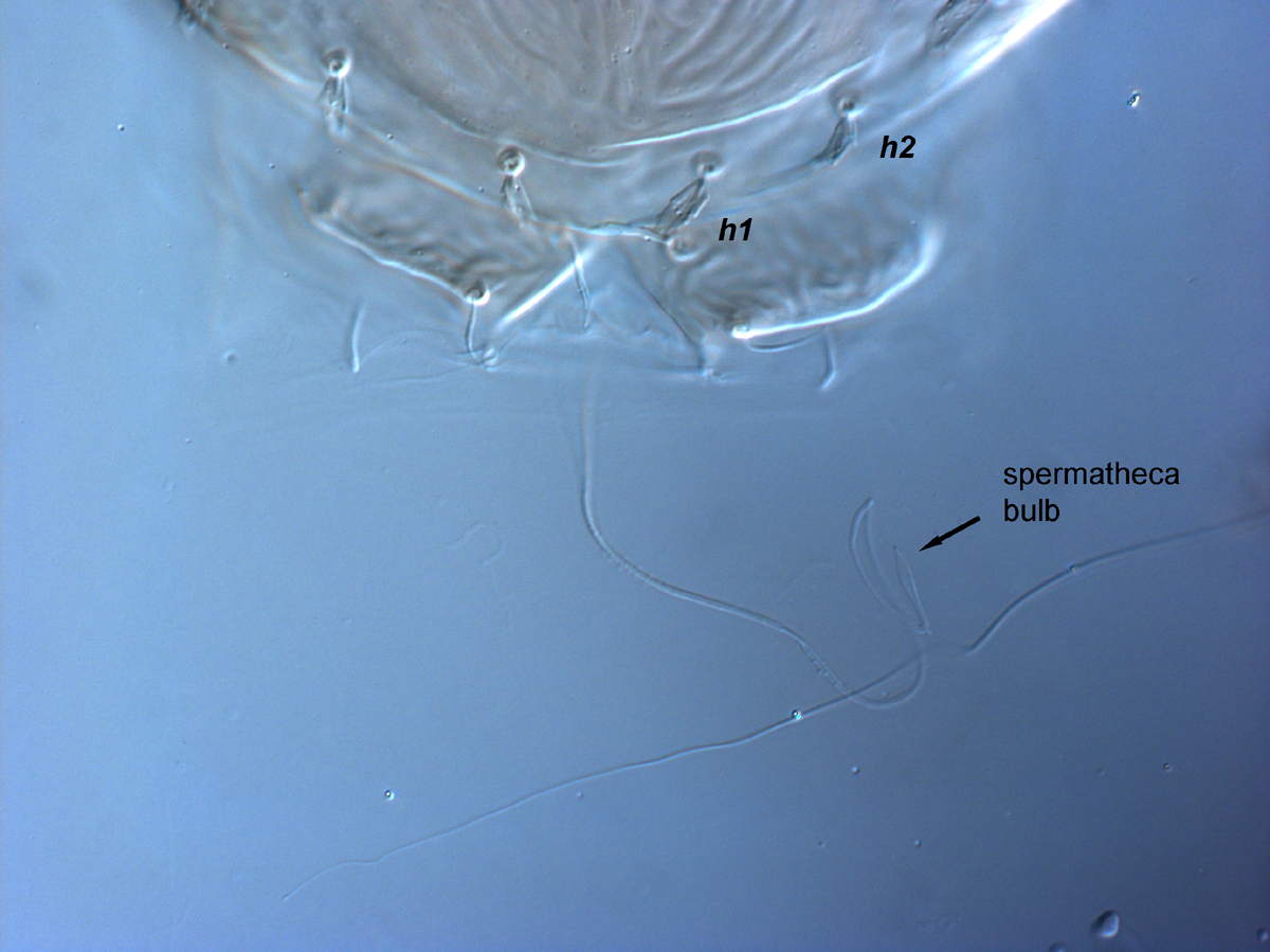  Fig. 12.  Brevipalpus ferraguti , female spermatheca, arrow indicating distal bulb. 