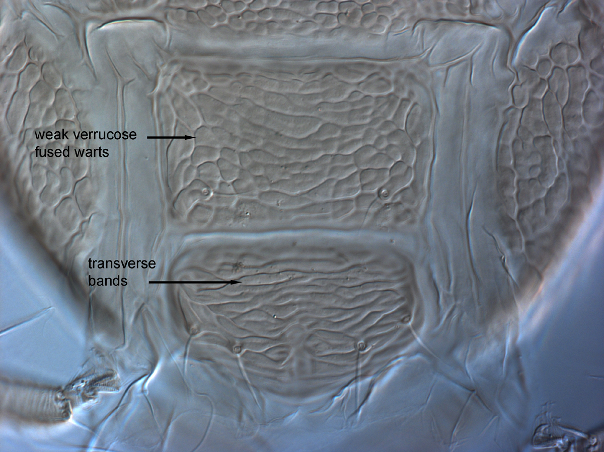  Fig. 11.  Brevipalpus ferraguti , female posterior venter. 