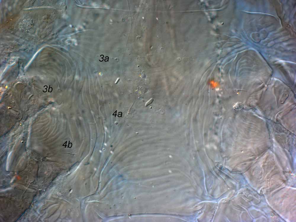            Fig. 11.   Brevipalpus frankeniae  female venter between coxae   III-IV (paratype).   