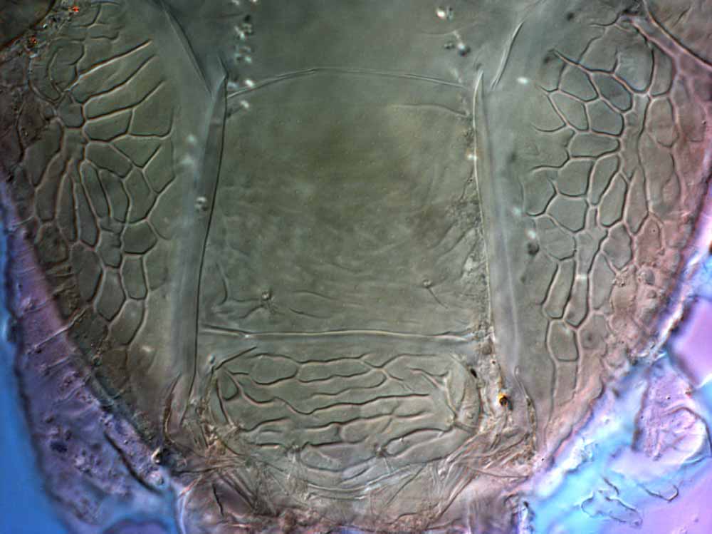            Fig. 10.   Brevipalpus frankeniae  female posterior venter   (paratype).   