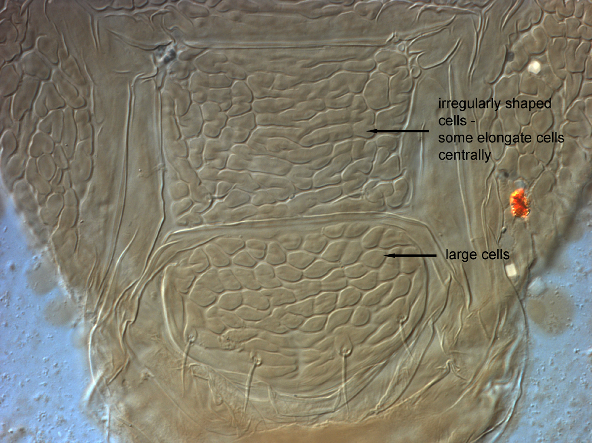            Fig. 7.  Brevipalpus hondurani  adult female posterior   venter.   