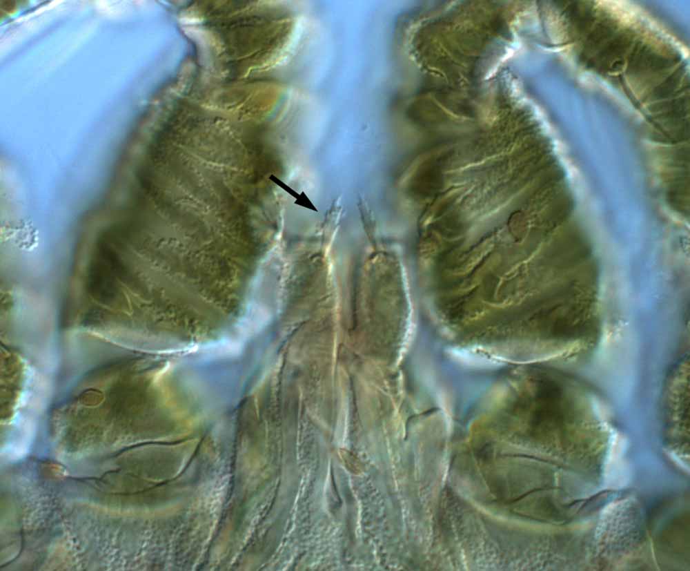            Fig. 18.   Brevipalpus obovatus  female palp - arrow indicates   seta on femur.   