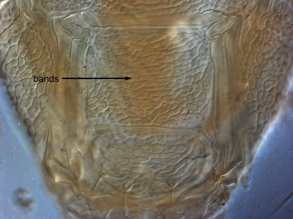            Fig. 14.   Brevipalpus obovatus  female posterior   venter.   