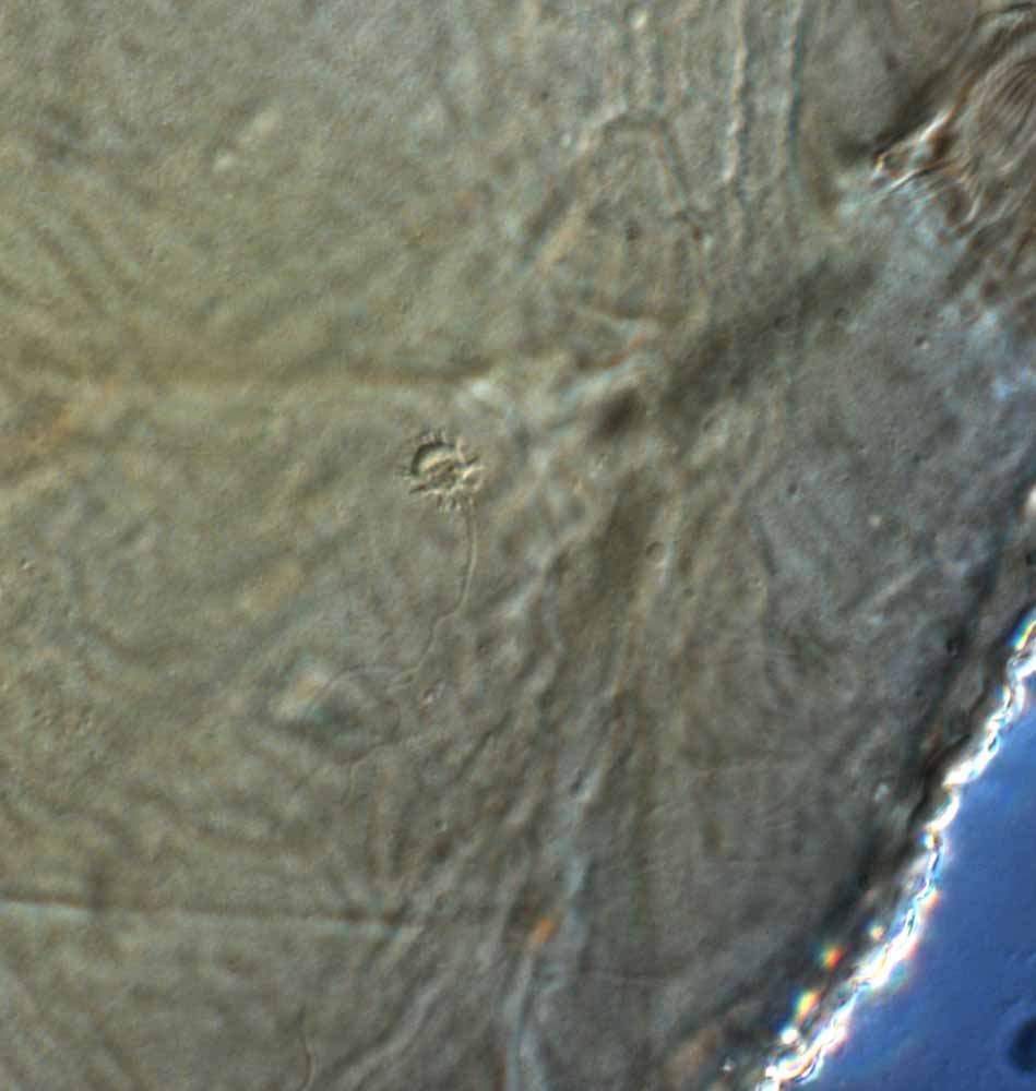            Fig. 15.   Brevipalpus obovatus  female   spermatheca.   