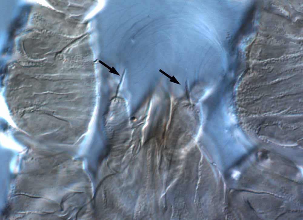            Fig. 19.   Brevipalpus obovatus  female palp - arrow indicates   seta on femur.   