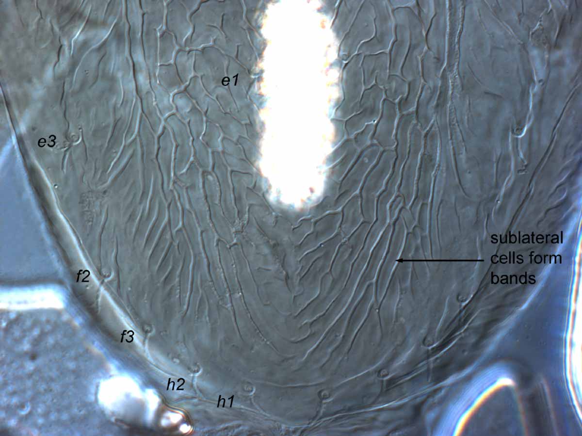            Fig. 7.   Brevipalpus lewisi  female posterior   dorsum.   