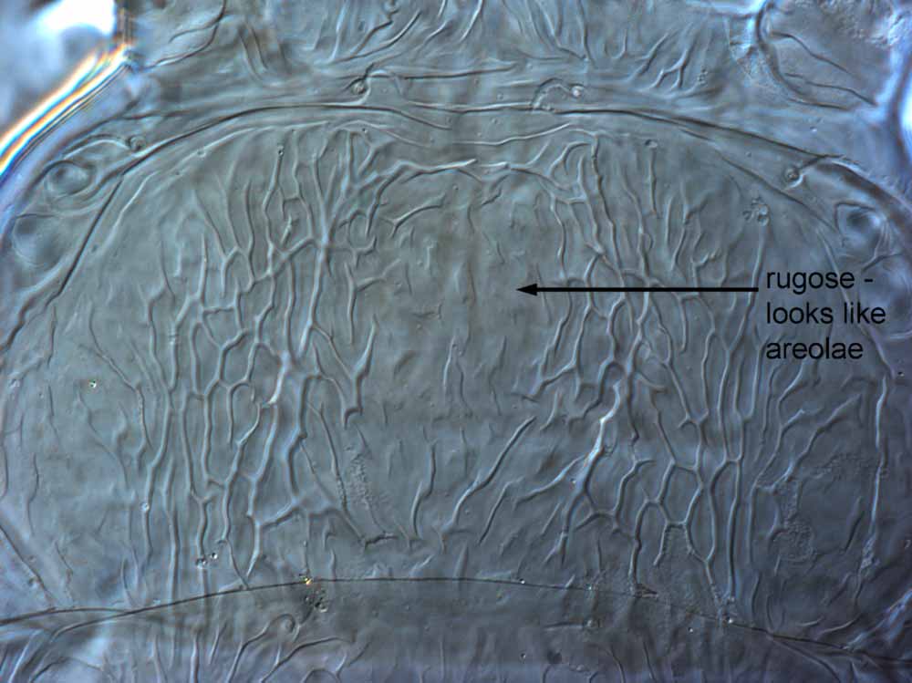            Fig. 3.   Brevipalpus lewisi  female prodorsum.   