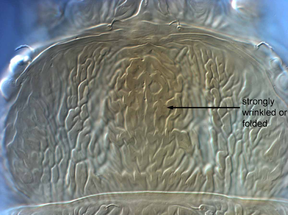            Fig. 2.   Brevipalpus lewisi  female prodorsum   (lectotype).   