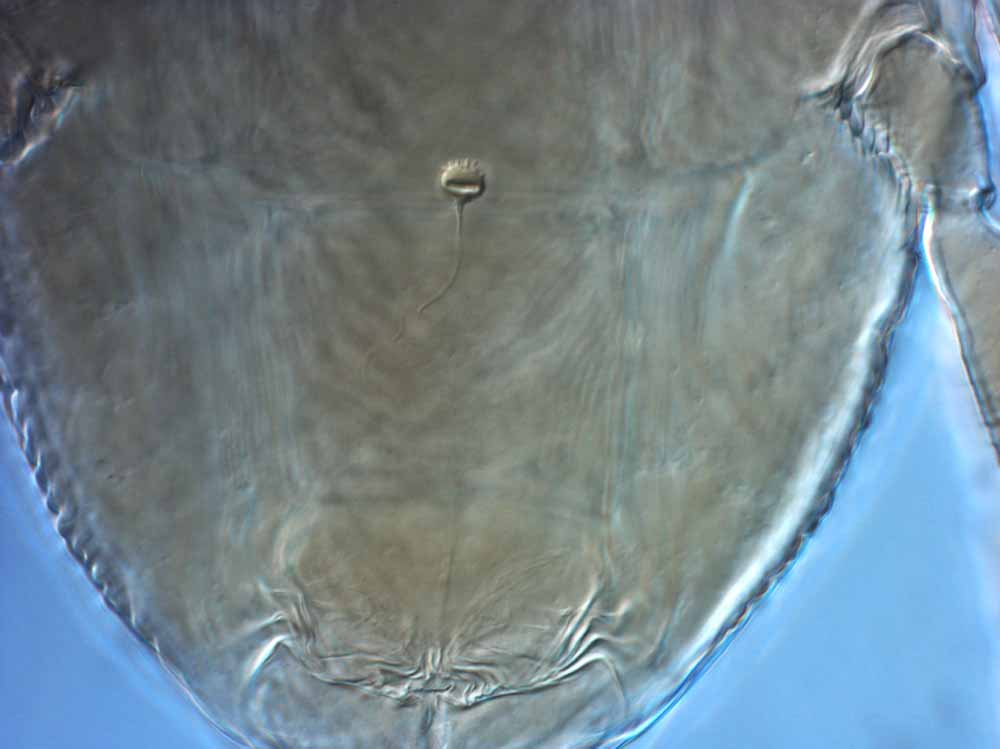            Fig. 10.   Brevipalpus lewisi  female spermatheca   (lectotype).   