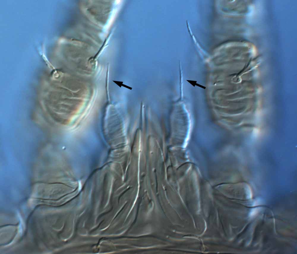            Fig. 12.   Brevipalpus lewisi  female gnathosoma - arrowings   indicating seta on palp femur (lectotype).   