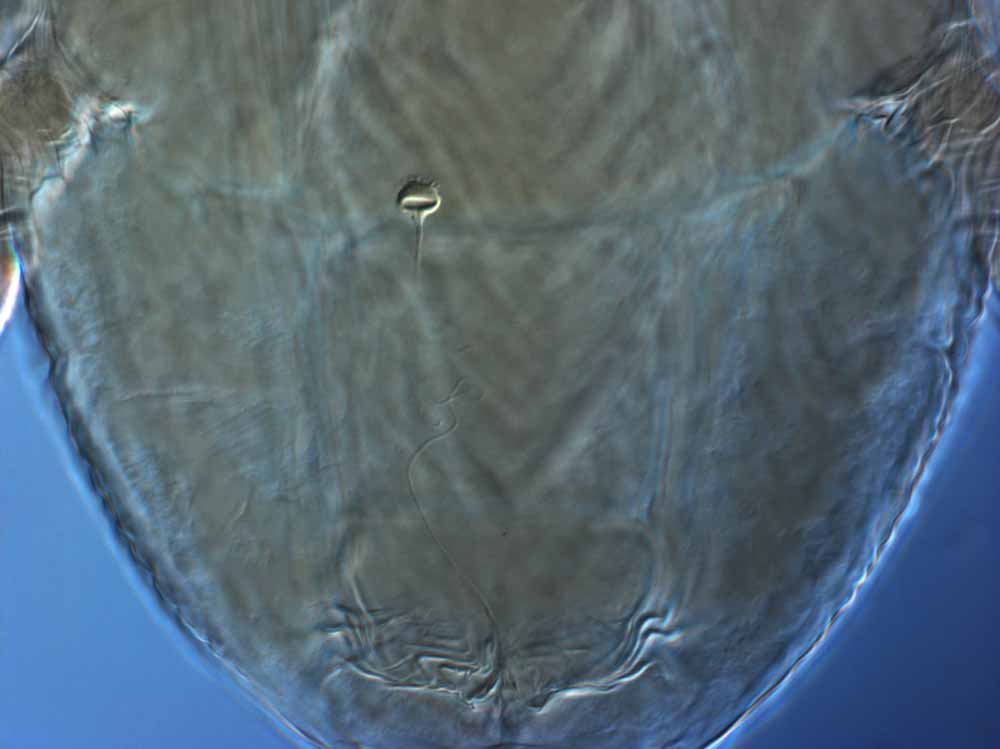            Fig. 11.   Brevipalpus lewisi  female spermatheca   (lectotype).   