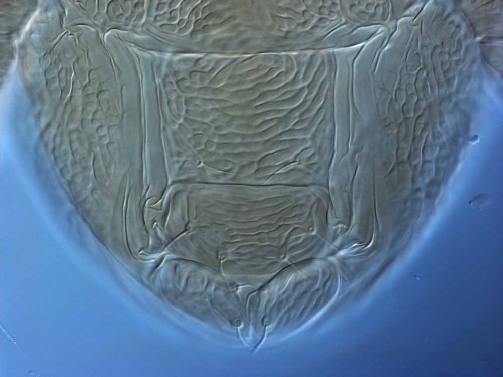            Fig. 9.   Brevipalpus lewisi  female posterior venter   (lectotype).   