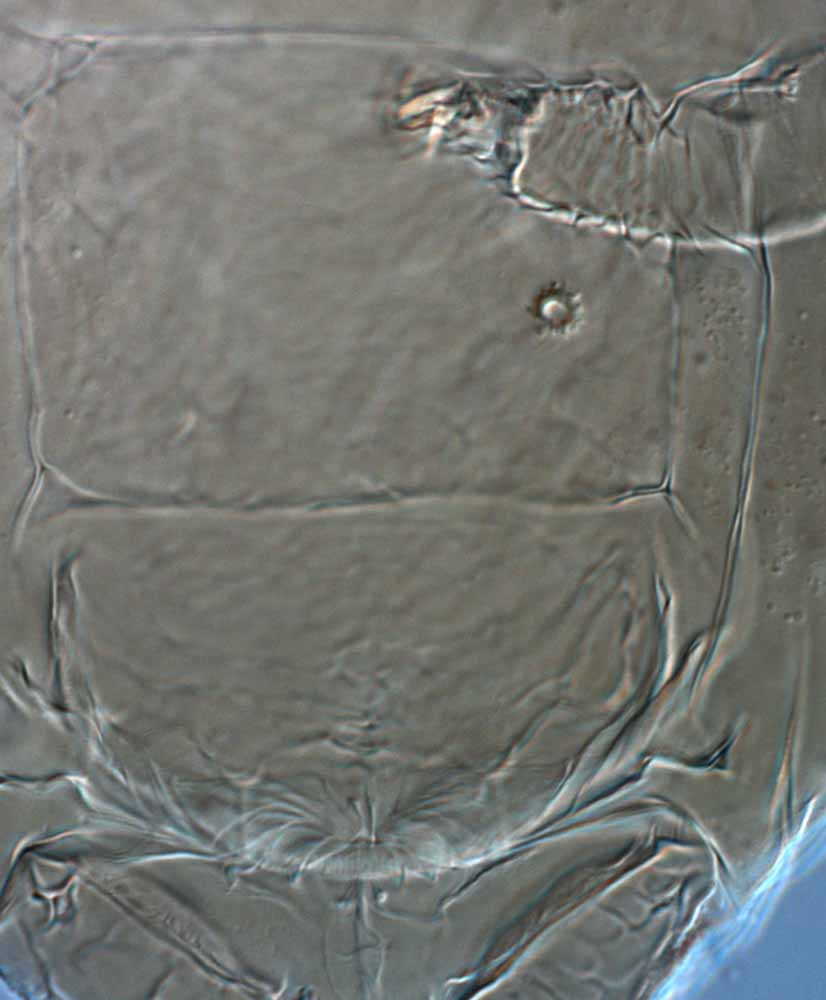            Fig. 17.   Brevipalpus obovatus  female   spermatheca.   