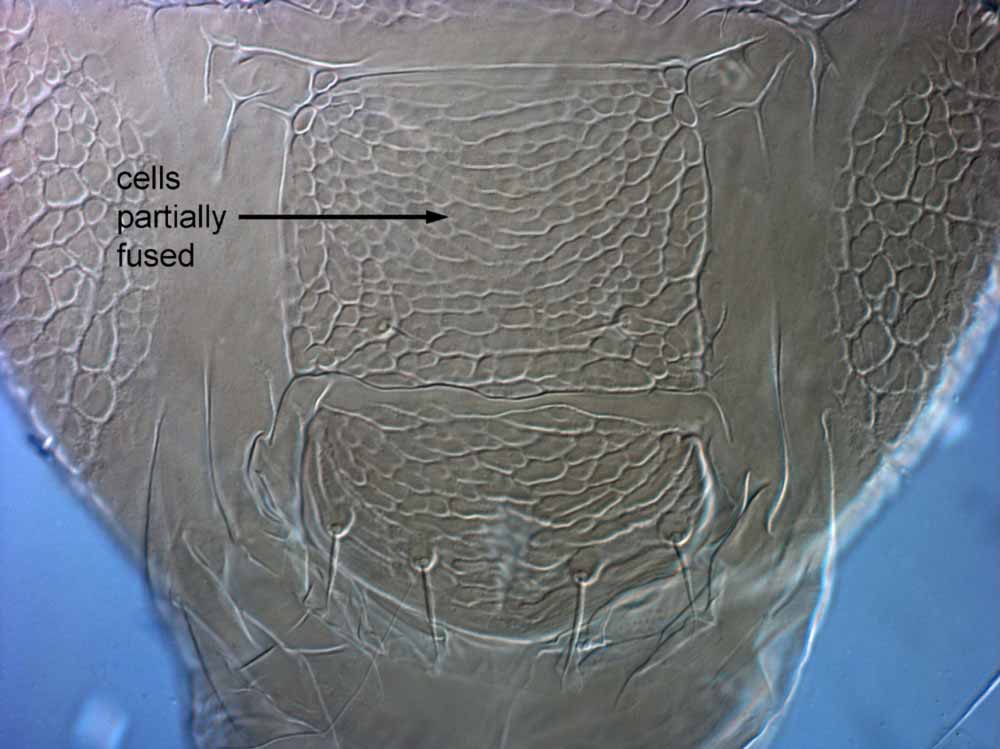            Fig. 12.   Brevipalpus obovatus  female posterior   venter.   