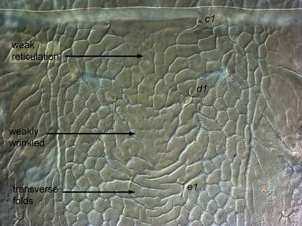            Fig. 7.   Brevipalpus obovatus  female dorsal anterior   opithosoma.   