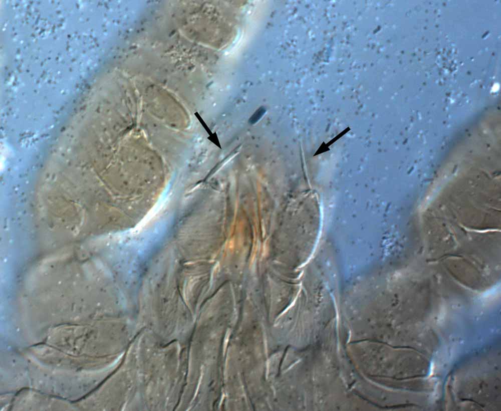            Fig. 20.   Brevipalpus obovatus  female palp - arrow indicates   seta on femur.   