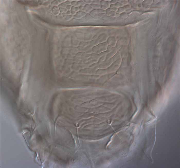            Fig. 7.   Brevipalpus  sp. female venter -   detail of ventral and genital plates.   