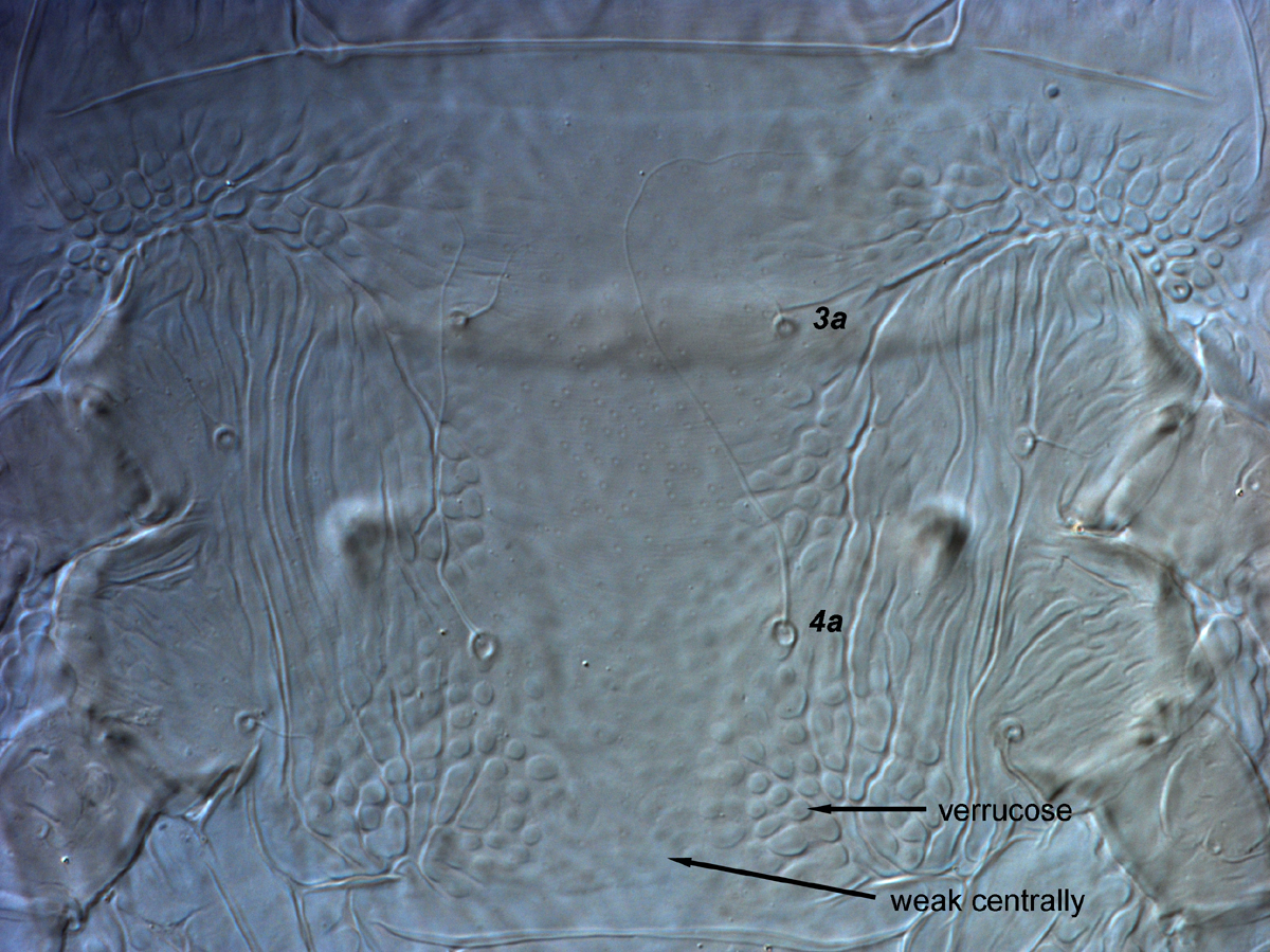  Fig. 12.  Brevipalpus yothersi , adult female venter, between coxae III-IV. 