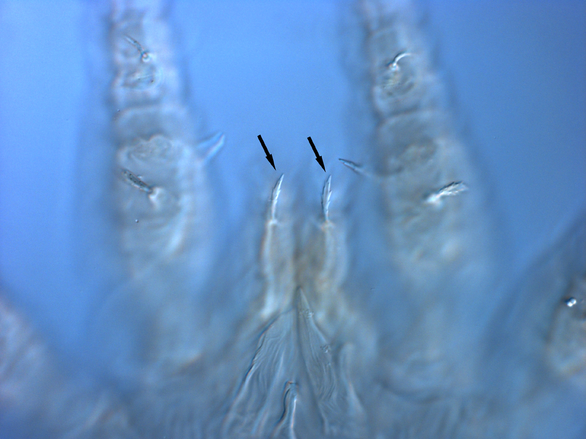  Fig. 9.  Brevipalpus azores , female dorsal seta on palp (indicated by arrows). 