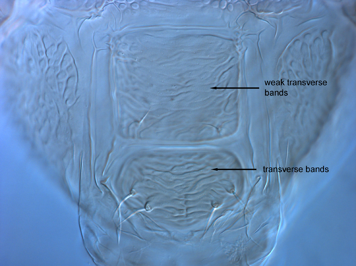  Fig. 13.  Brevipalpus azores , female posterior venter. 