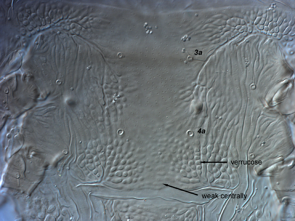  Fig. 13.  Brevipalpus yothersi , adult female venter, between coxae III-IV. 