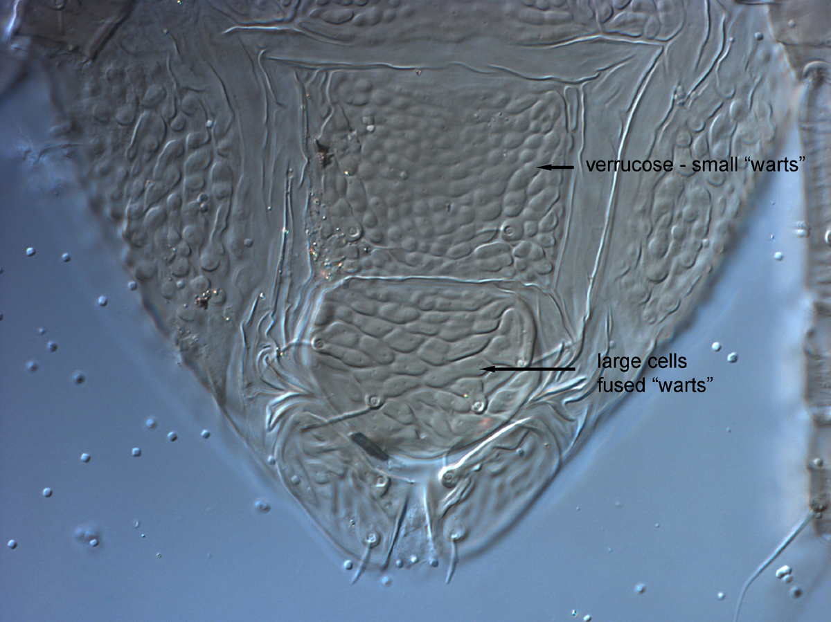  Fig. 15.  Brevipalpus yothersi , adult female posterior venter. 