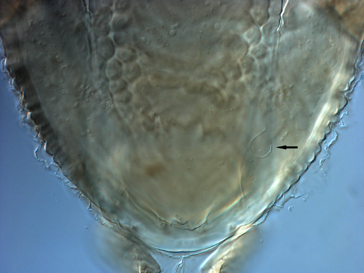  Fig. 16.  Brevipalpus phoenicis  sensu stricto, female spermatheca (arrow indicates the distal membranous bulb). 